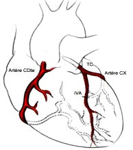 artères coronnaires gauche et droite